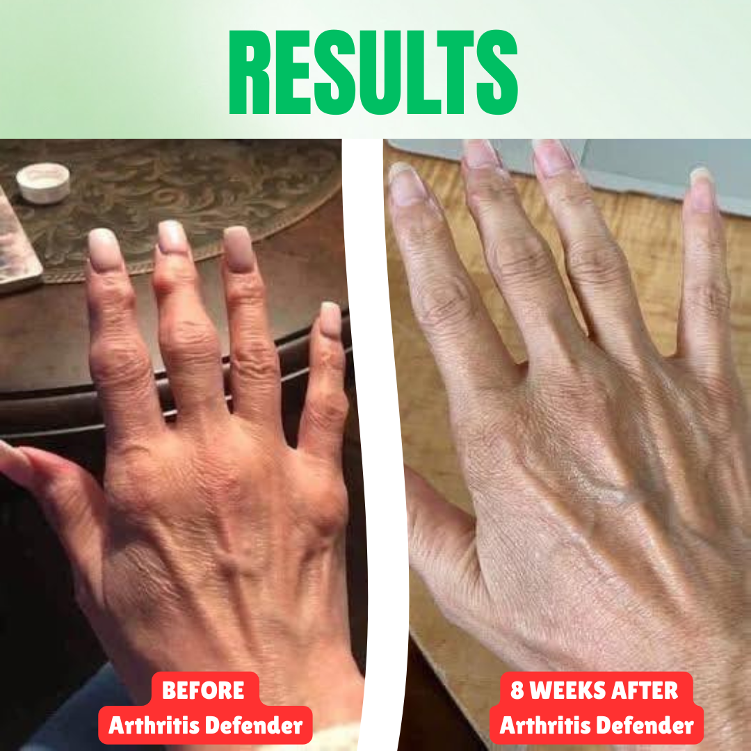 Aruma Arthritis Defender™