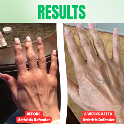Aruma Arthritis Defender™